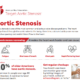American Heart Association: Aortic Stenosis Fact Sheet