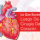 [Spanish] The Society of Thoracic Surgeons: What to Expect After Surgery