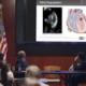 A Briefing on Emerging Issues in Mitral Valve Disease